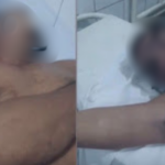 Trabalhadores rurais morrem após ingerirem bebida alcoólica artesanal em Tuntum